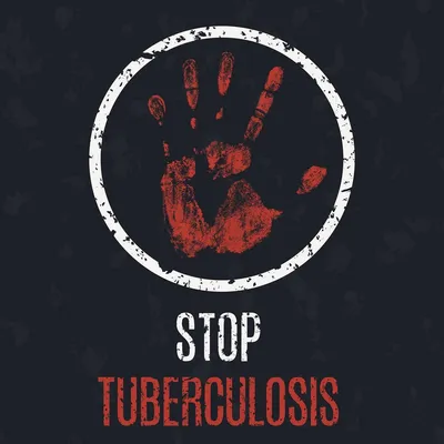 Это должен знать каждый»: туберкулез