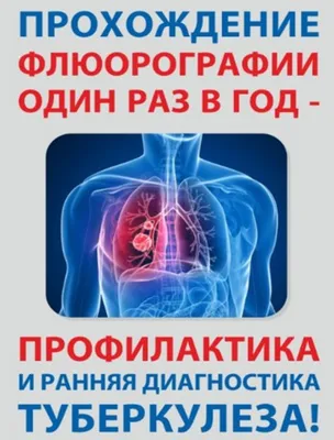 24 марта - Всемирный День борьбы с туберкулезом! | 22.03.2023 | Архангельск  - БезФормата