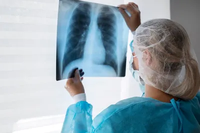 Туберкулез внелегочный - причины появления, симптомы заболевания,  диагностика и способы лечения