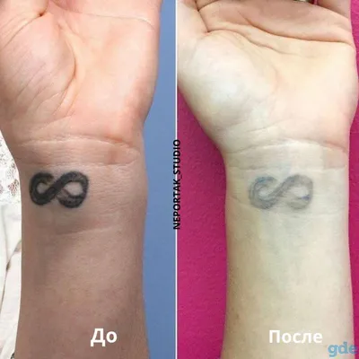 Изображения удаления татуажа бровей в формате PNG