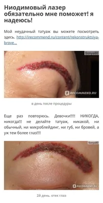 Фото удаления татуажа губ с использованием инновационных методов