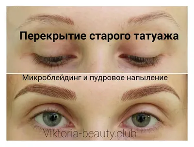 Картинки удаления татуажа ремувером для онлайн-магазинов