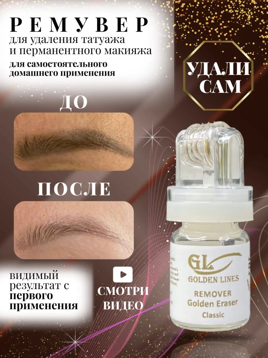 Изображения процесса удаления татуажа ремувером в домашних условиях Изображения процесса удаления татуажа ремувером в домашних условиях