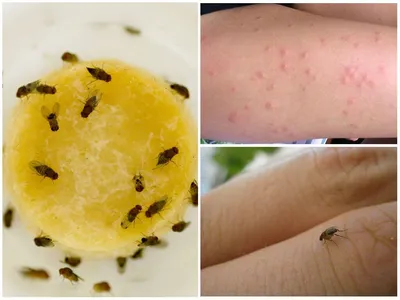 Как защитить ребенка от укусов насекомых