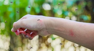 Укусы насекомых и меры их профилактики — Горловка