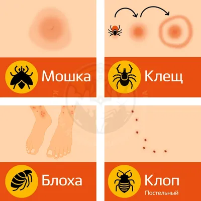Как различить укусы насекомых, чем они опасны, как оказать помощь?
