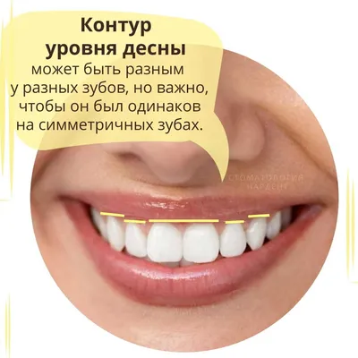 Идеальная улыбка зубов
