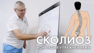 Сколиоз у детей — как выявить и чем лечить