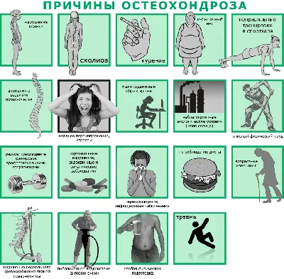 Гимнастика при СКОЛИОЗЕ, КИФОЗЕ, ОСТЕОХОНДРОЗЕ, часть 2. Упражнения для  спины и исправления осанки. - YouTube