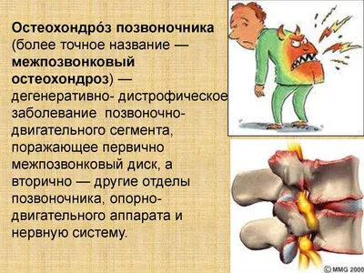 Подборка упражнений и гимнастики при шейном остеохондрозе — Аспект Здоровья