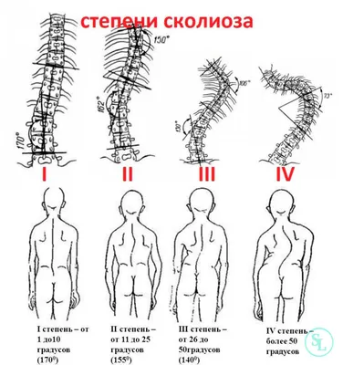 Гимнастика от остеохондроза шеи | Доктор Демченко - YouTube