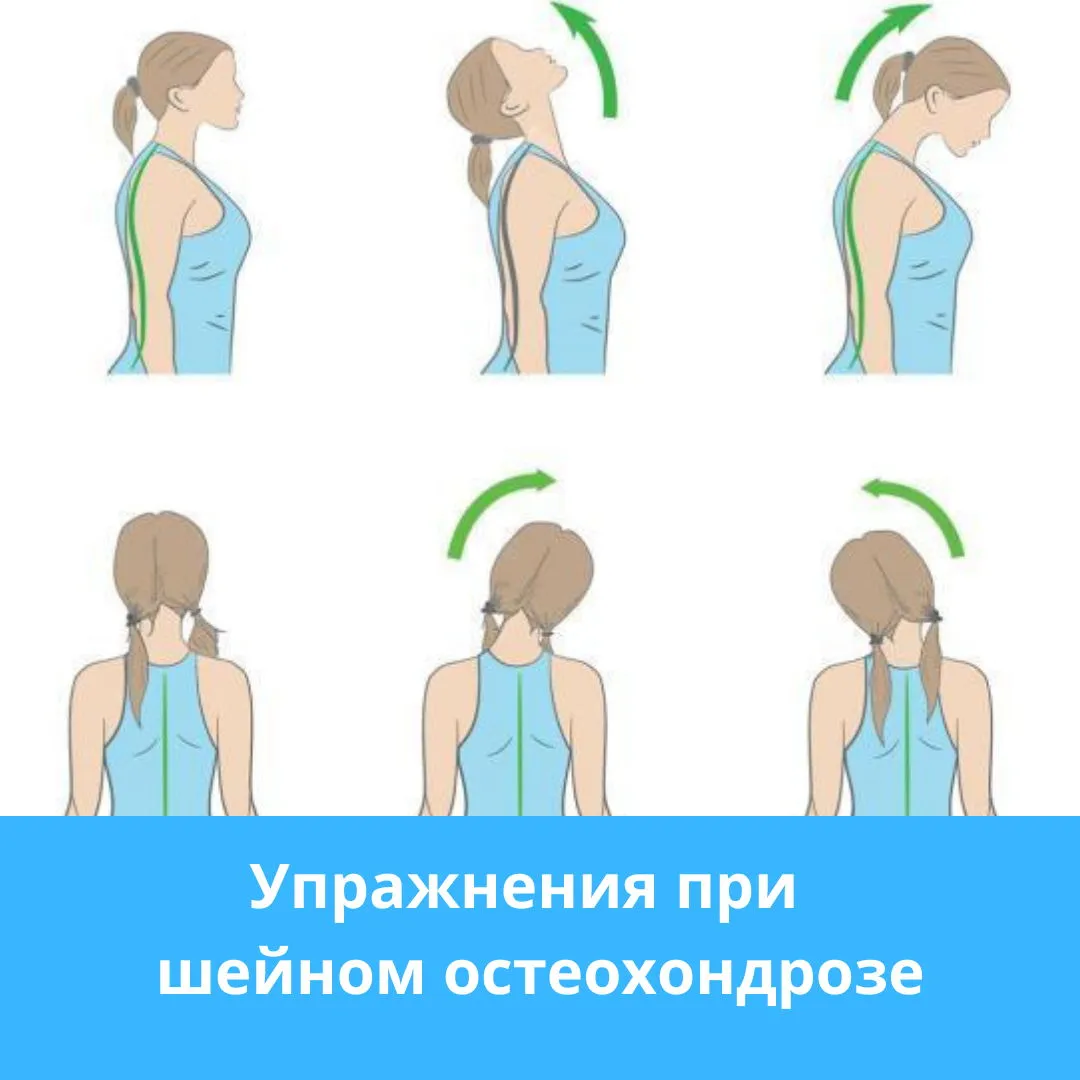 Сколиоз остеохондроз грудного отдела позвоночника