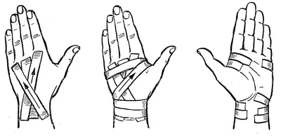 Ушиб руки на фото: бесплатное изображение для блога или сайта