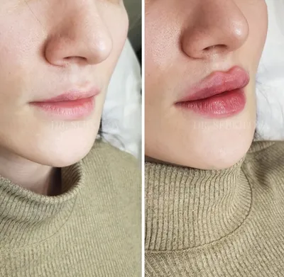 Как сделать губы более объемными на изображении