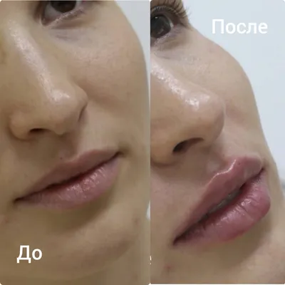 Фото увеличенных губ: как сделать, чтобы они выглядели естественно при любом освещении