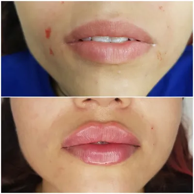 Фото увеличенных губ: как правильно подобрать оттенок помады