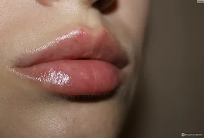 Фотоувеличение губ: как это работает
