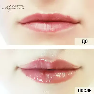 Фотоэффект увеличения губ: как получить желаемый результат
