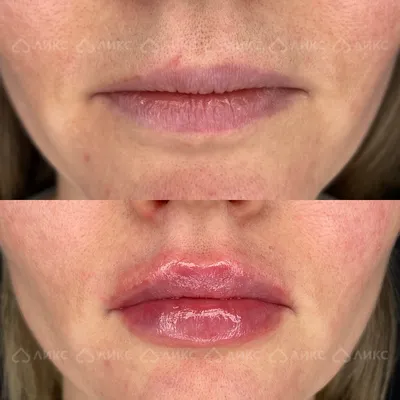 Как сделать увеличенные губы более естественными на фото