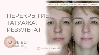Картинка ужасного татуажа бровей: когда профессионалов нет рядом