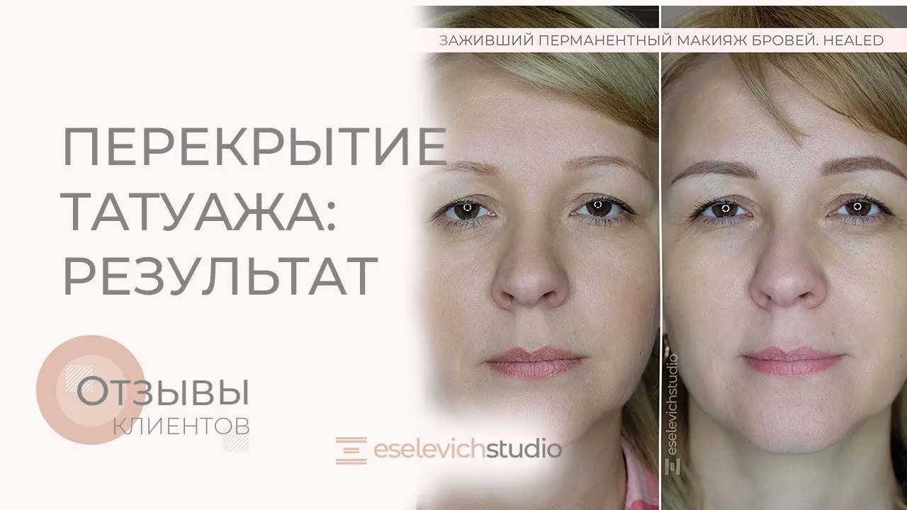 Картинка ужасного татуажа бровей: когда профессионалов нет рядом Картинка ужасного татуажа бровей: когда профессионалов нет рядом