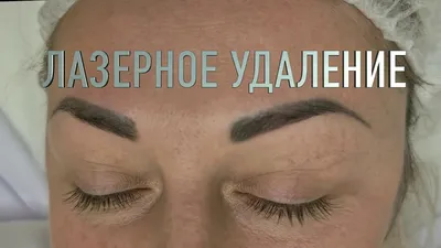 Фото ужасного татуажа: маленький размер