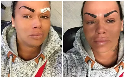 Фотография неудачного татуажа