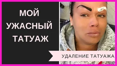Фото испорченного татуажа: какие ошибки произошли