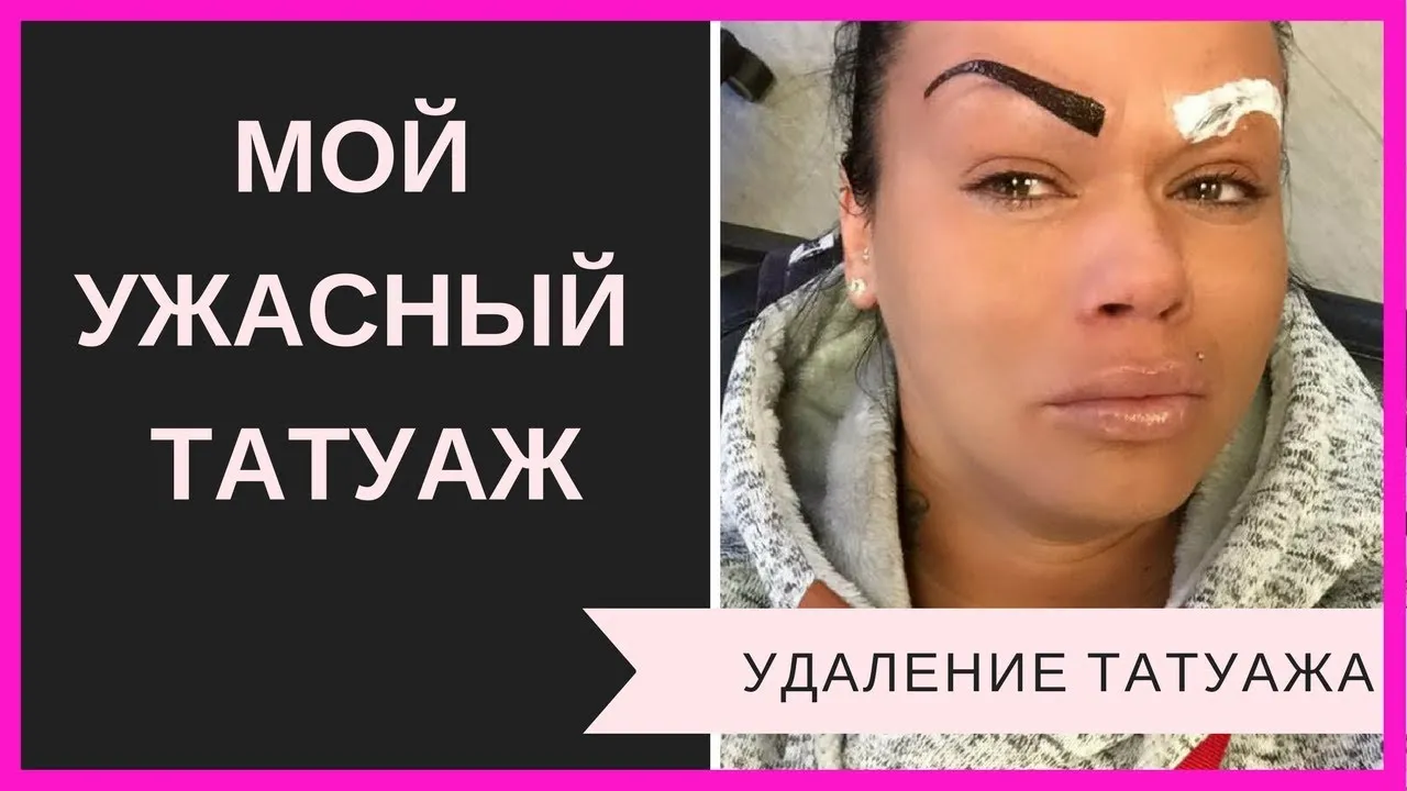 Фото испорченного татуажа: какие ошибки произошли Фото испорченного татуажа: какие ошибки произошли