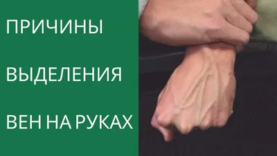 Изображение венозных узоров на руке