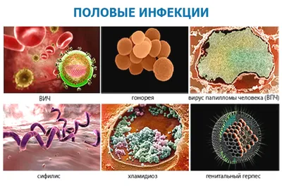 Венерологические заболевания картинки