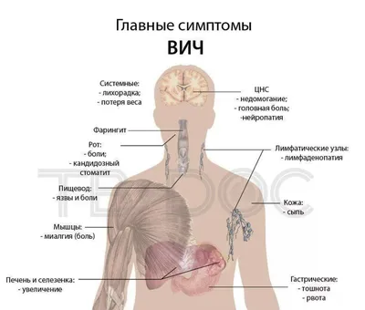 ВИЧ - причины появления, симптомы заболевания, диагностика и способы лечения