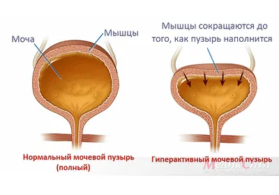 Лечение Ректальных Заболеваний Геморроя Проктолог Указывающий Патологии  Прямой Кишки Пера На Анатомическую Модель — стоковые фотографии и другие картинки  Геморрой - iStock