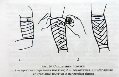Виды повязок. Правила наложения бинтовых повязок - презентация онлайн