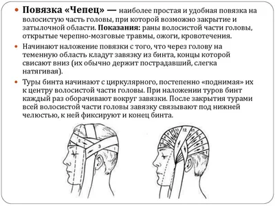 Виды повязок. Правила наложения бинтовых повязок - презентация онлайн