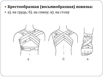 Травмы: перелом лучевой кости со смещением и без / вывих / трещина –  Лечение и восстановление