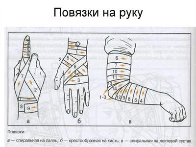 Повязка картинки (47 фото) » Юмор, позитив и много смешных картинок