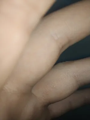 Изображение водянистых пузырьков на пальцах рук в стиле эко