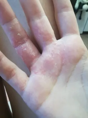 Изящные водяные пузырьки на пальцах рук