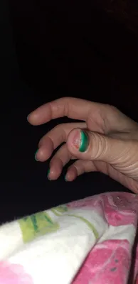 Уникальные фото водяных пузырьков на пальцах рук
