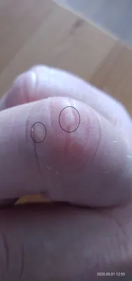 Фотографии водяных пузырьков на пальцах рук в формате PNG