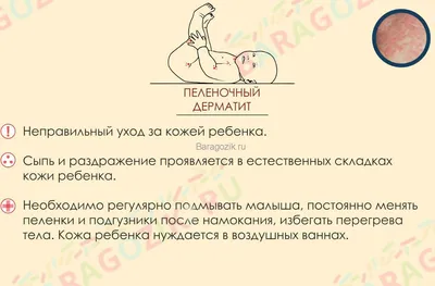 Волдыри на руках у ребенка: простые советы для родителей