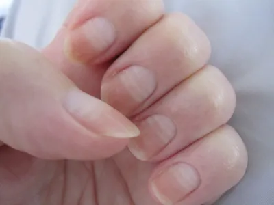 Изображение волнистых ногтей на руках: тренды маникюра