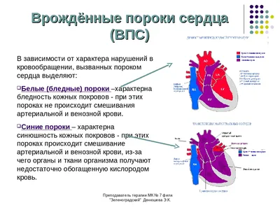 Врожденные пороки сердца - Шарыкин А.С., Купить c быстрой доставкой или  самовывозом, ISBN 978-5-9518-0368-9 - КомБук (Combook.RU)