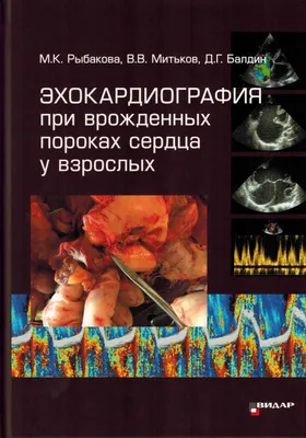 Врожденные пороки сердца у взрослых — особенности современной тактики  лечения, отдаленный прогноз - YouTube