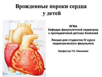 PDF) Congenital Heart Diseases in Children: Incidence, Risk Factors,  Mortality