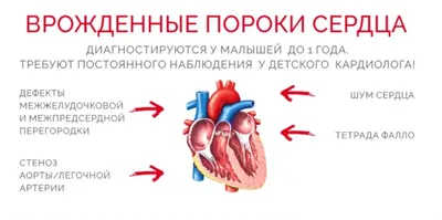 Файл STL Врожденные пороки сердца - 7 упаковок 🎒・Дизайн 3D принтера для  загрузки・Cults