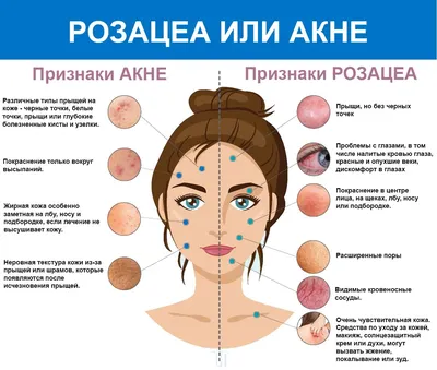 Рак под маской кожного заболевания. История пациентки.