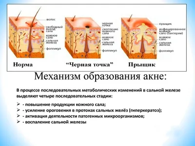 Доктор медицинских наук Иван Неумывакин: «Сто раз говорил и еще повторю!  Любые кожные заболевания лечатся, если…» | Заболевания, Медицинский, Советы