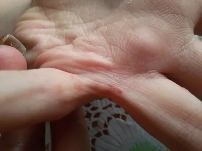 Советы по уходу за кожей при высыпаниях на руках у ребенка